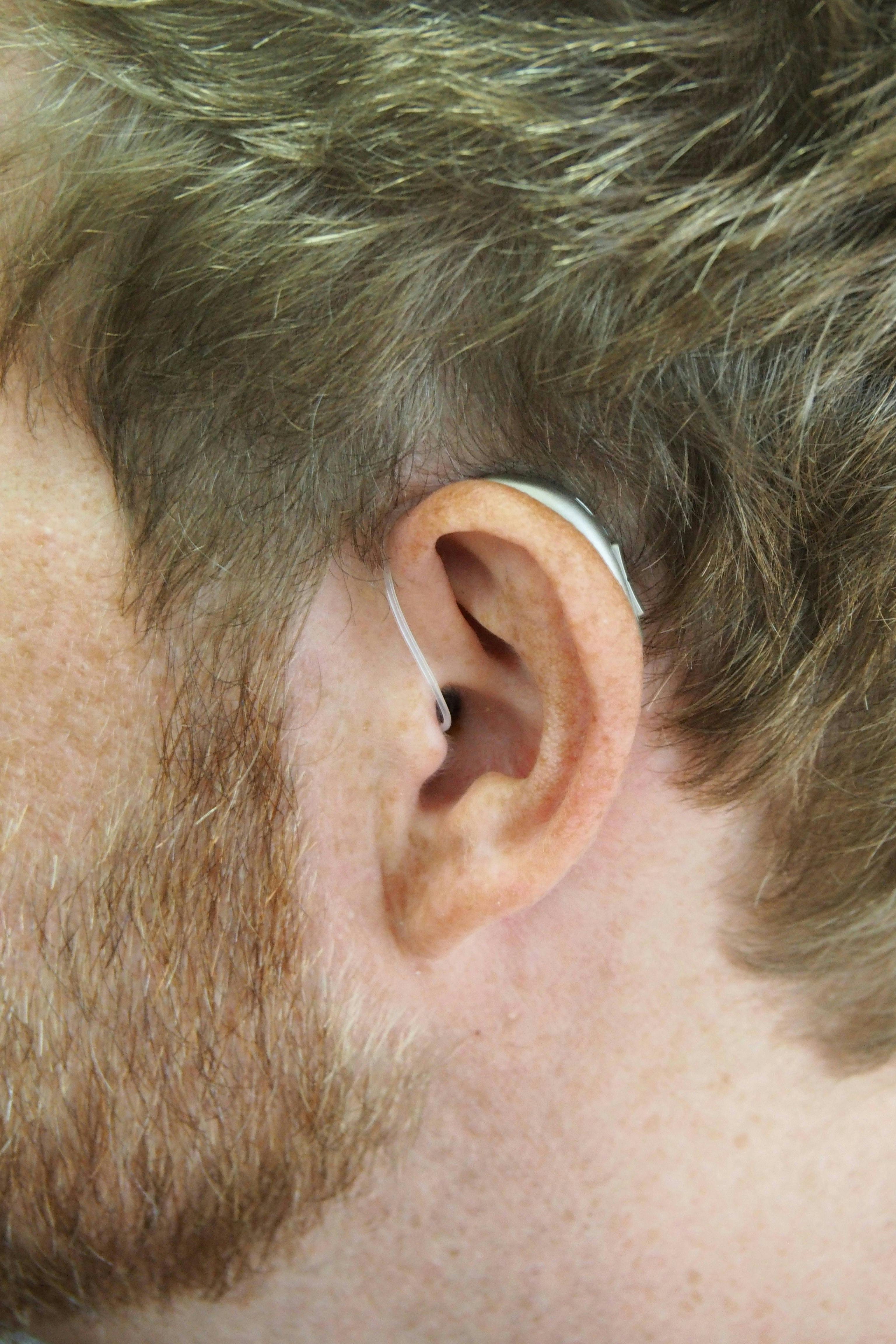 A close up of a man's ear with a hearing aid fitted